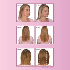 BosleyMD mendXtend Strengthening System