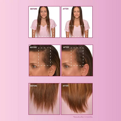 BosleyMD mendXtend Strengthening System